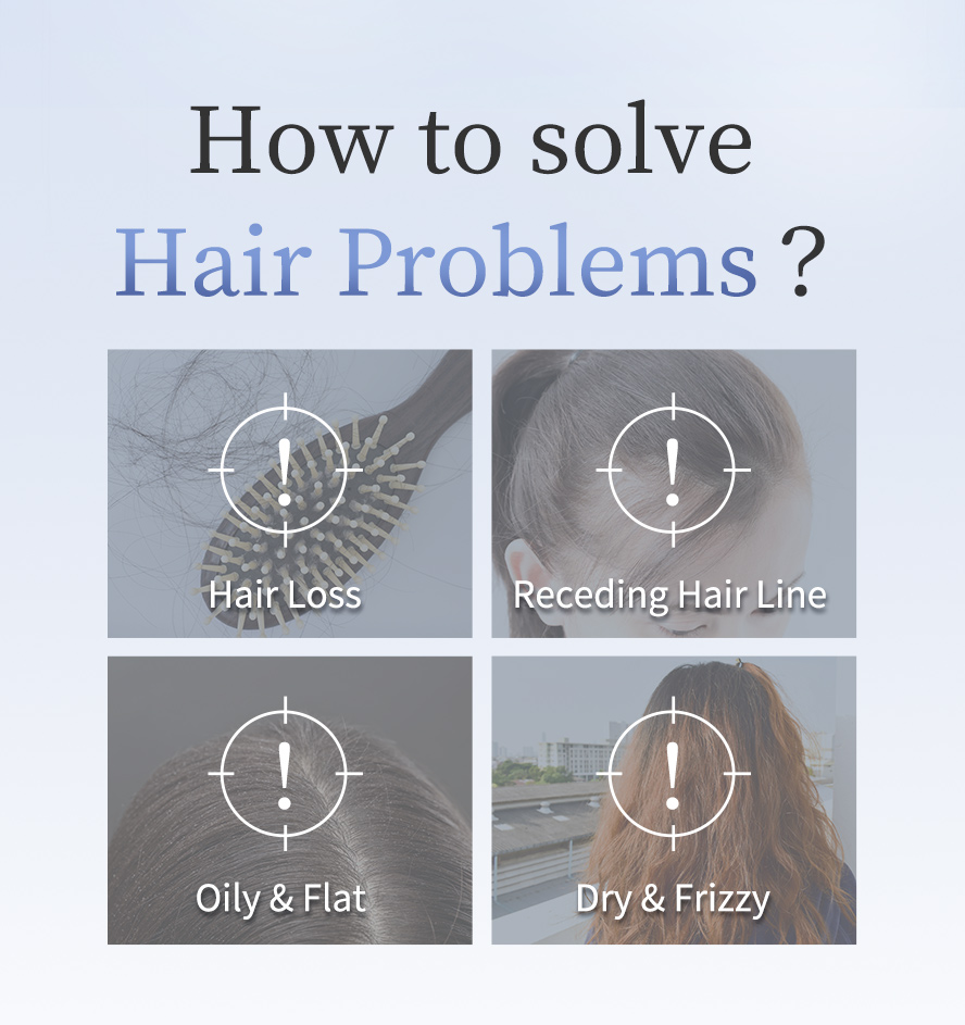 How to solve serious hair loss, redecding hair line, oily flat hair roots and dry frizzy hair? 