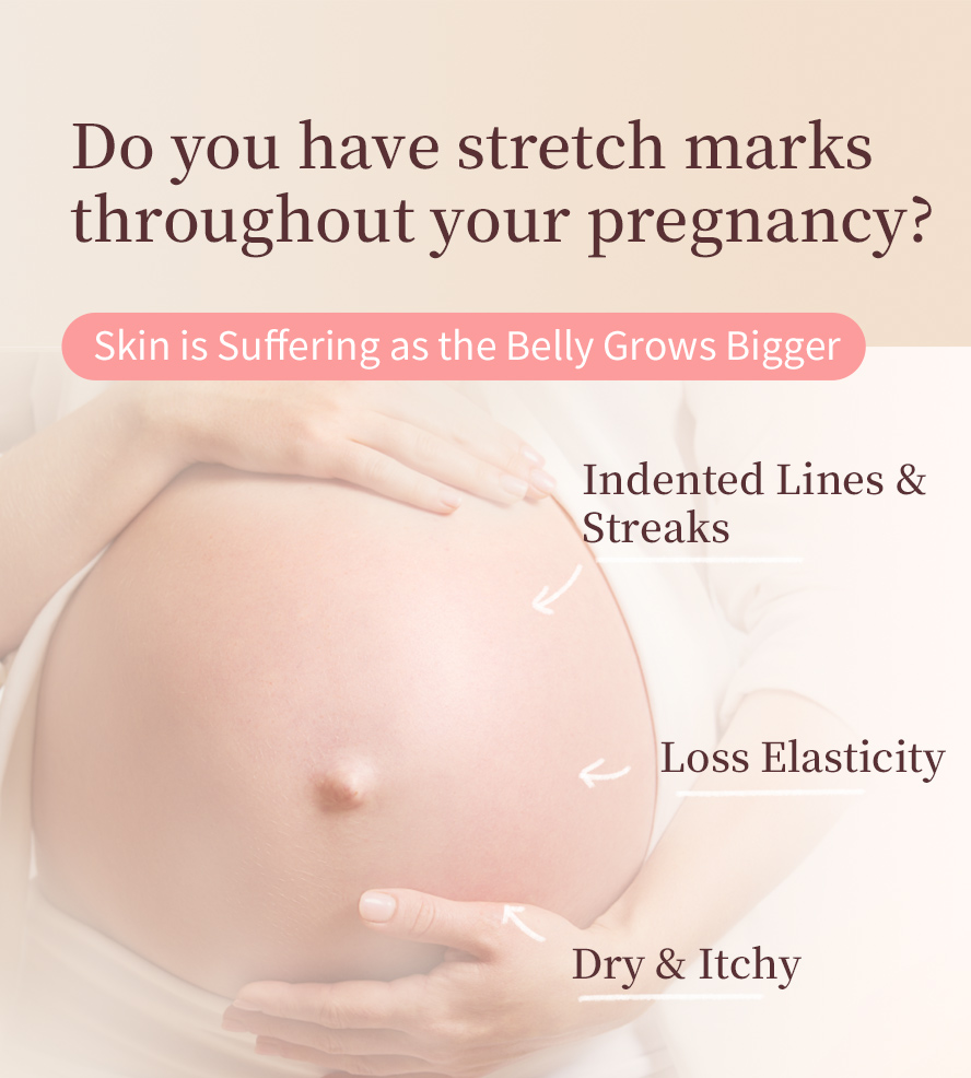 Skin is suffering as baby grows in the belly and causes indented lines and streaks, losing elasticity and dry itchy skin