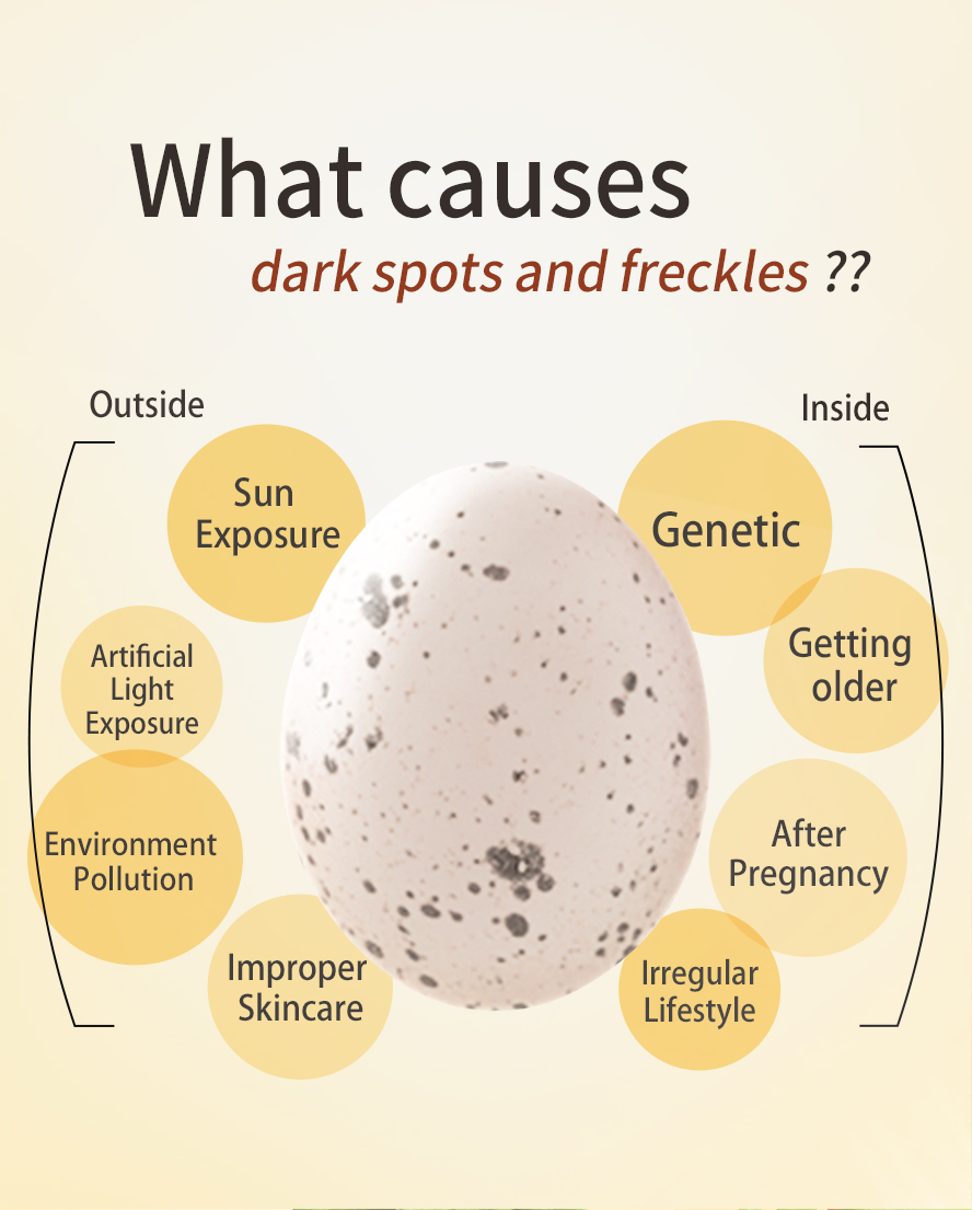 Too much exposure to the sun, hereditary factors, and hormonal imbalance cause freckles.