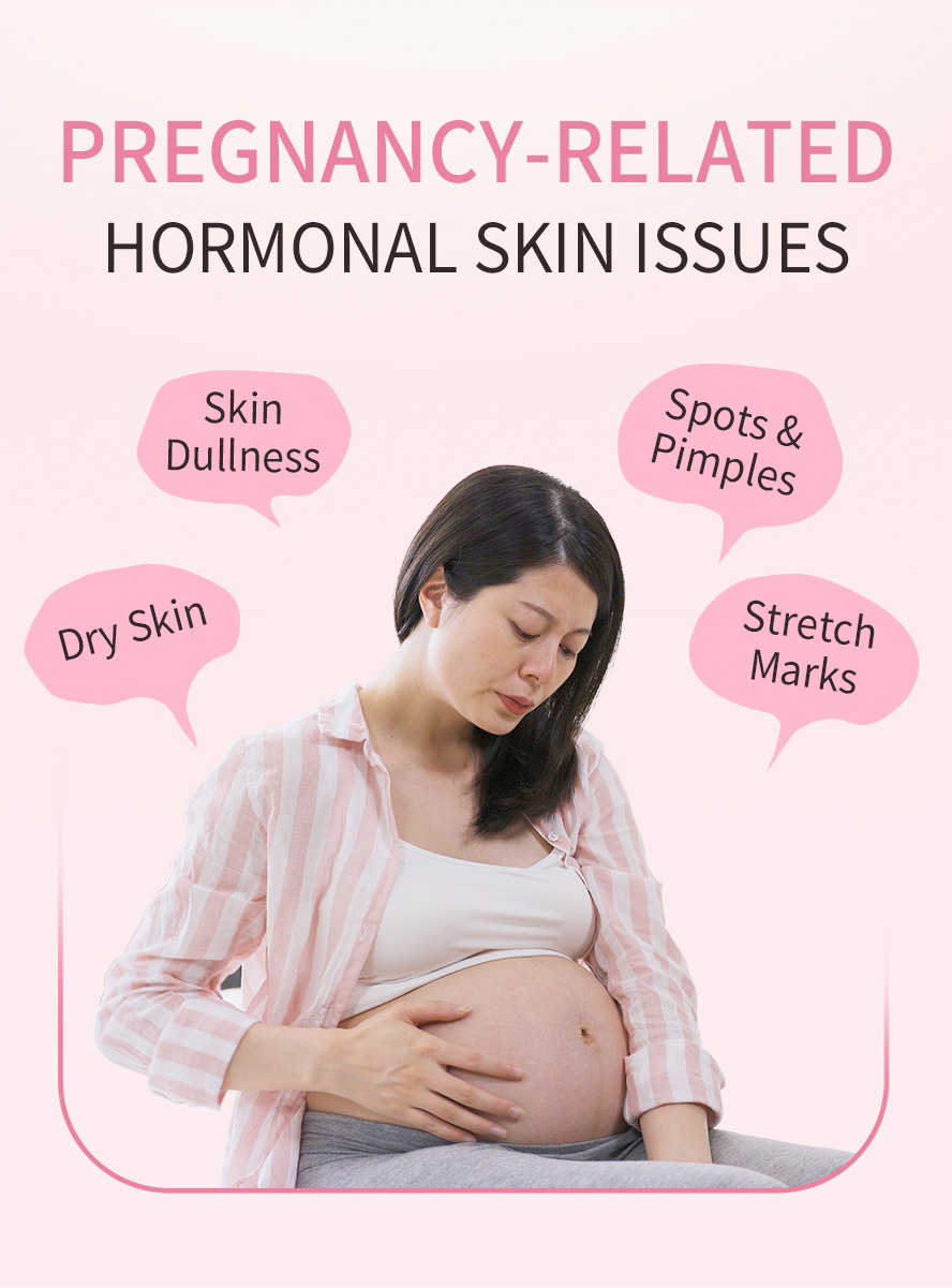 Pregnant momies will experience dry, dull skin, melanin spots and stretch marks due to hormone change.