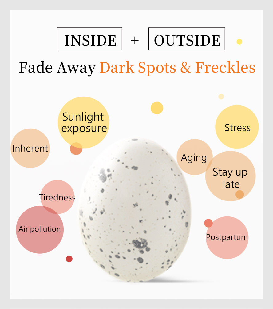 Too much exposure to the sun, hereditary factors, and hormonal imbalance cause freckles.