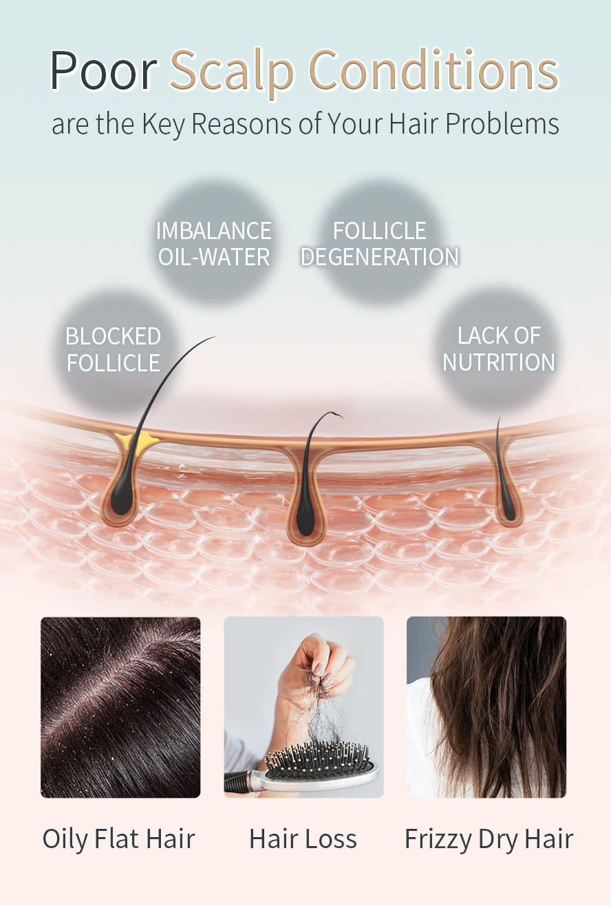 BHK's Hair Tonic can solve scalp problems, oly scalp, dandruff, serious hair loss & frizzy hair