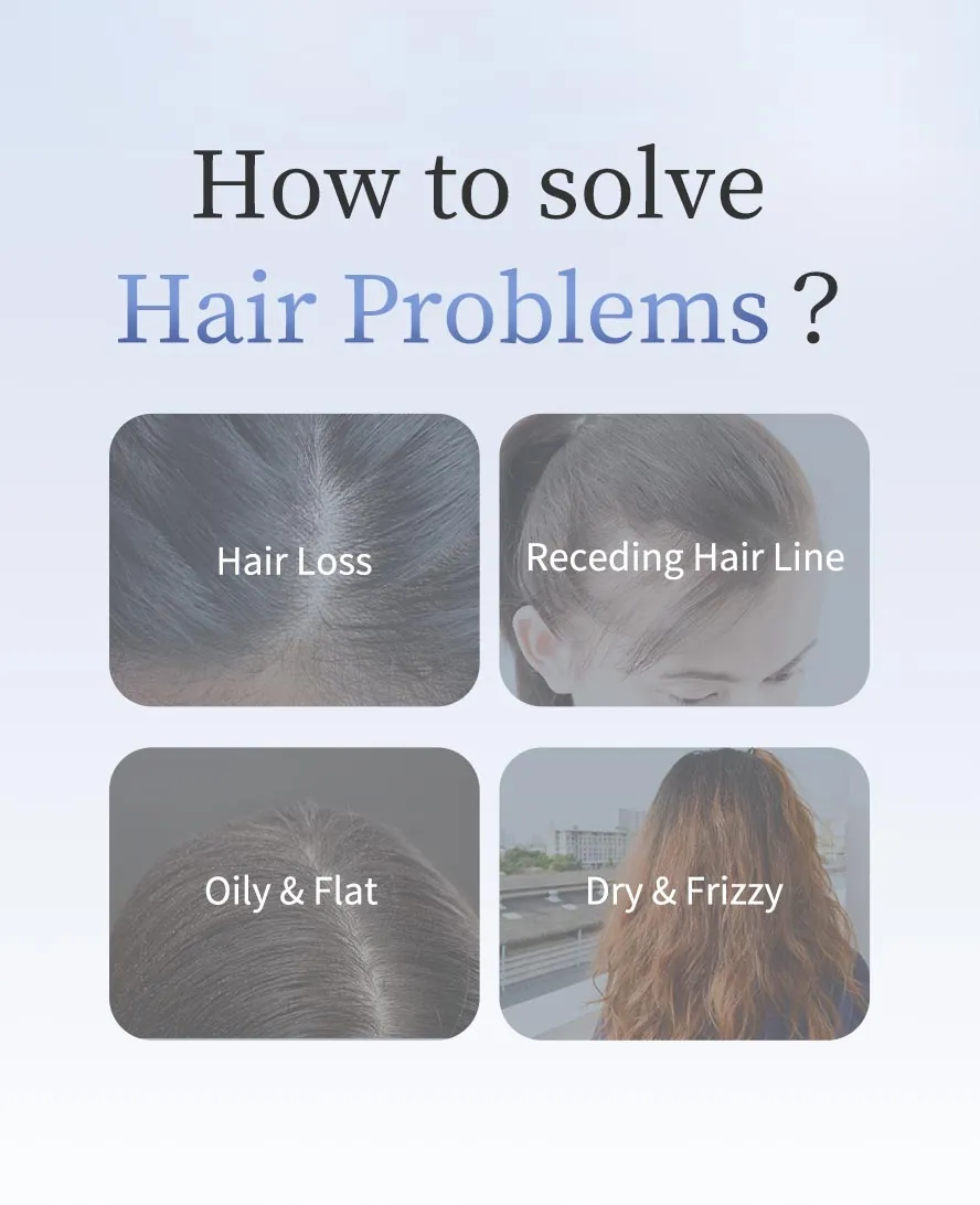 How to solve serious hair loss, redecding hair line, oily flat hair roots and dry frizzy hair?