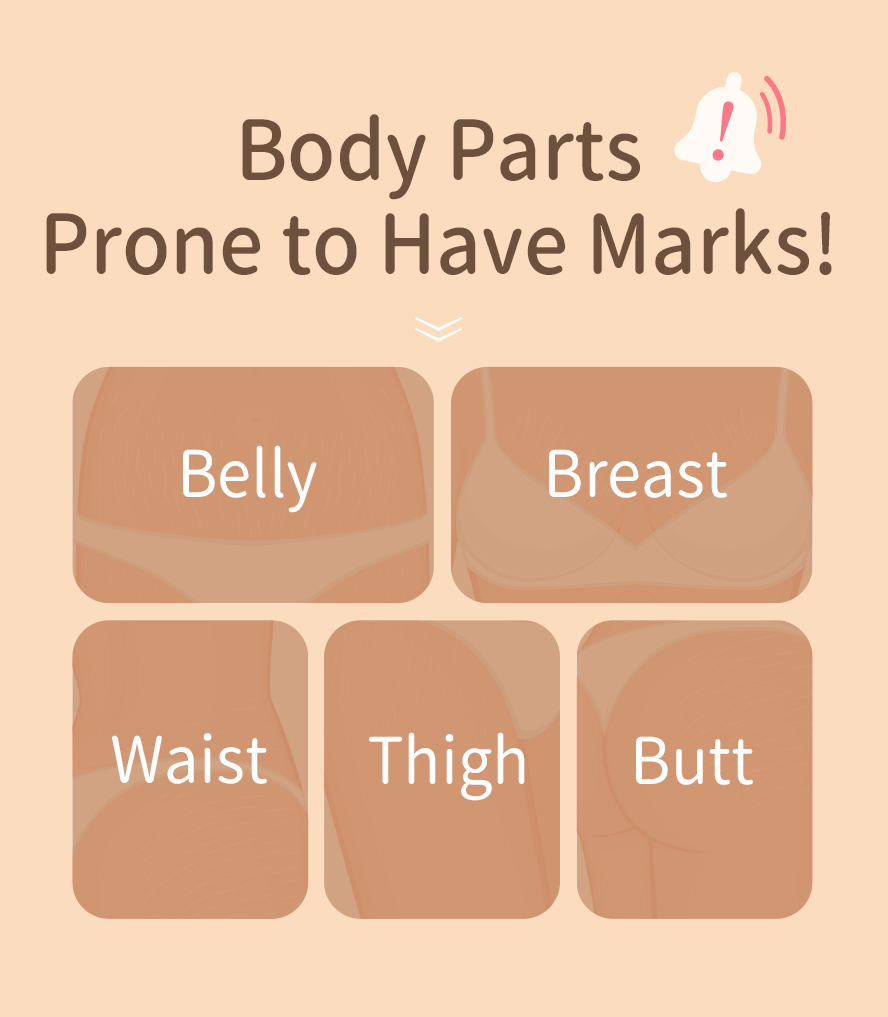 Pregnant belly are prone to appear marks.