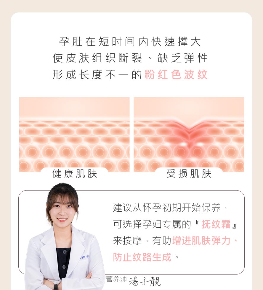 为什么会有孕纹、母子线产生呢?因肚子快速隆起、妈咪胖太快加上色素沉淀，导致皮肤弹性组织受损。