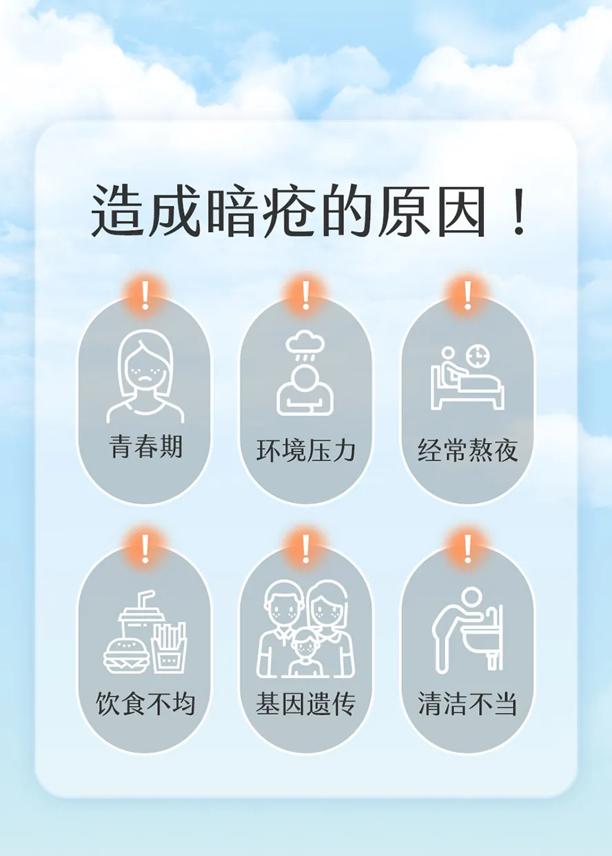 为什么会长痘?为什么会长暗疮?
