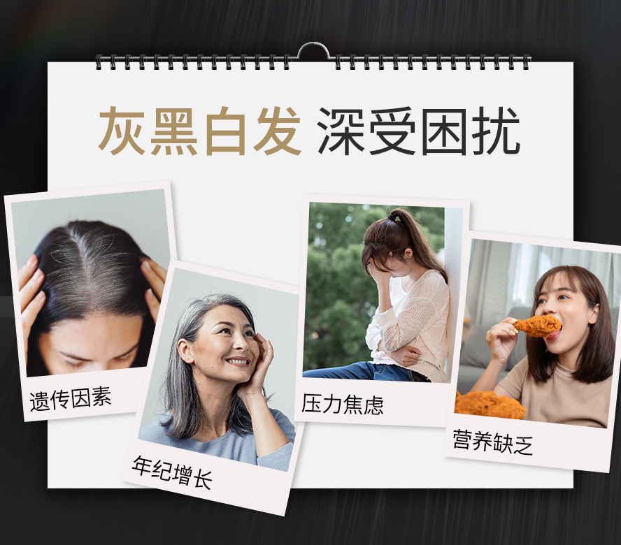 遗传、压力大、营养不足都是造成发丝变灰白的原因。