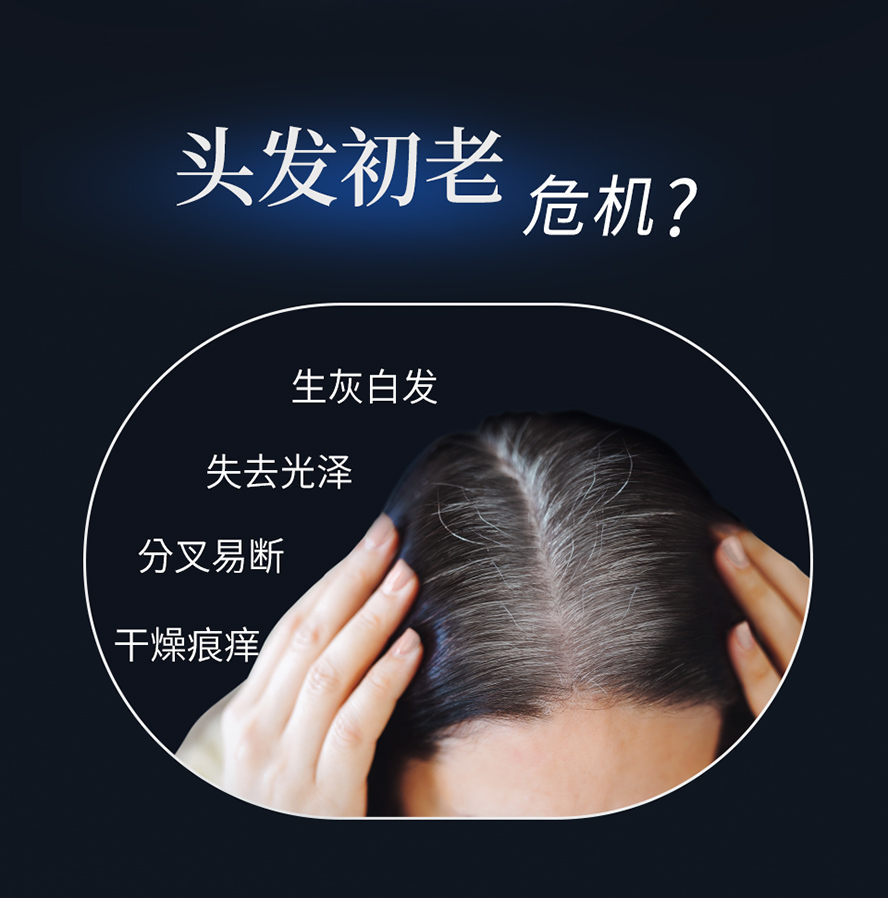 头发灰白、无光泽原因、分叉易断、干燥痕痒、白头发变多等，头发面临初老危机。