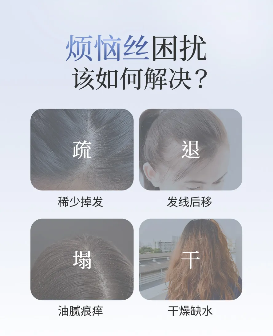 如何改善头发问题