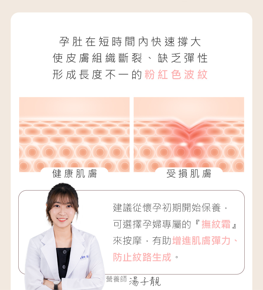 為什麼會有孕紋、母子線產生呢?因肚子快速隆起、媽咪胖太快加上色素沉澱，導致皮膚彈性組織受損。