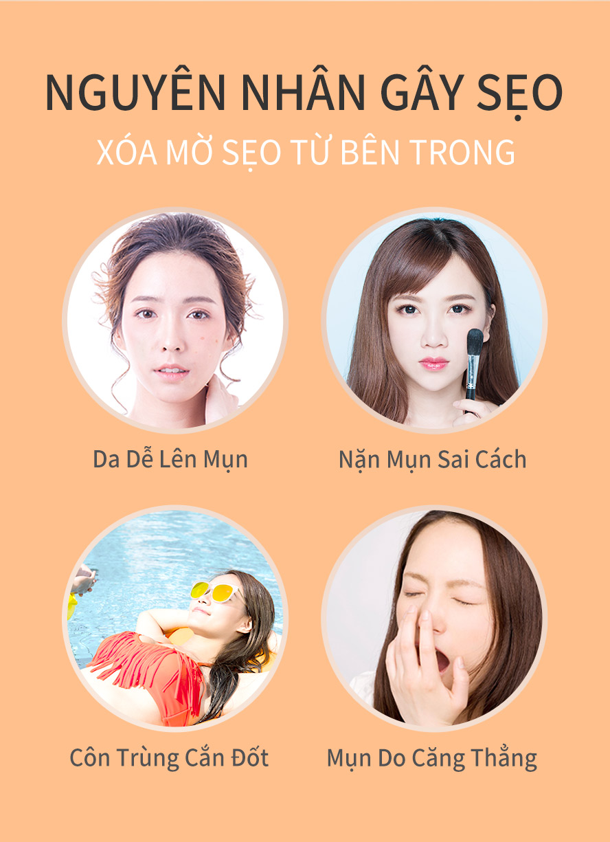 thích hợp cho những người có sẹo mụn ,và những sẹo khác